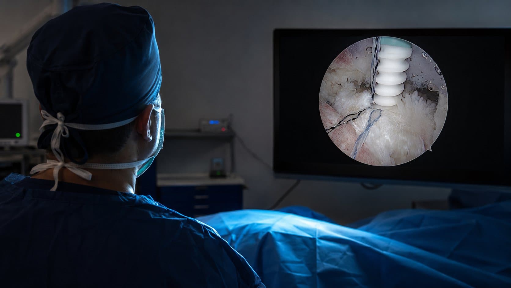 Dr. Raffo operating, arthroscopic view on the monitor